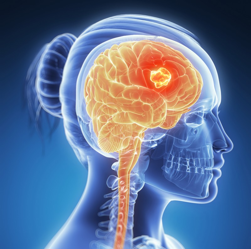 Does Brain Size Predict Brain Cancer Risk?