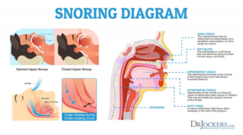 Snoring Can Worsen Heart Function, Especially In Women